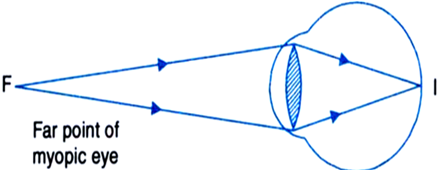 
(i) When the student is seated at the last desk, the image of the bla