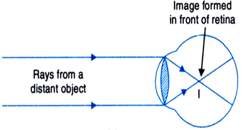 
(i) When the student is seated at the last desk, the image of the bla